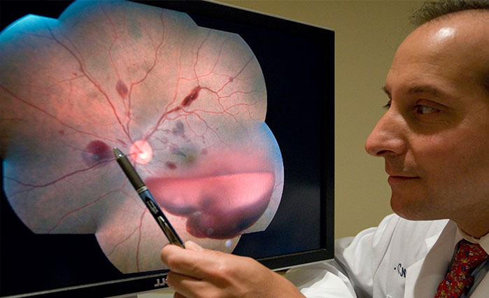 NYEE Retina Services