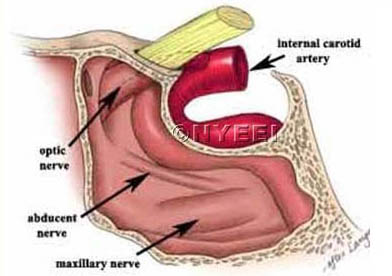 Sinus Ear Throat ache