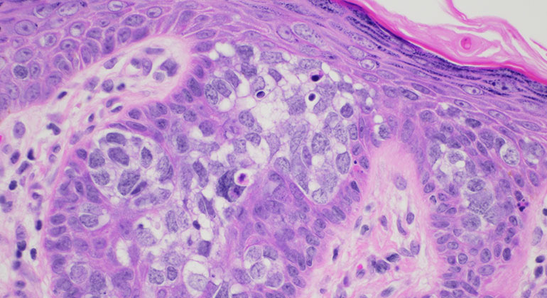 Pathology image