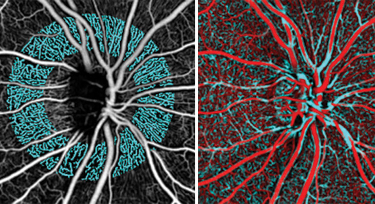 Adaptive optics under a microscope