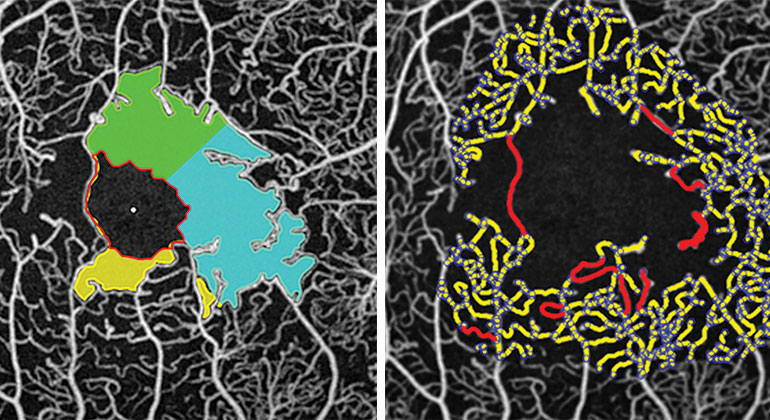 Adaptive optics under a microscope