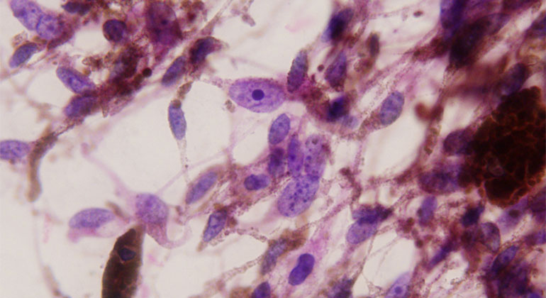 pathology image