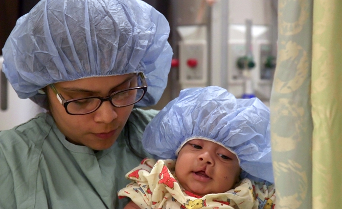 Baby with incomplete cleft lip