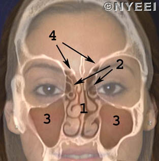 skull base tumor types signs symptoms nyee