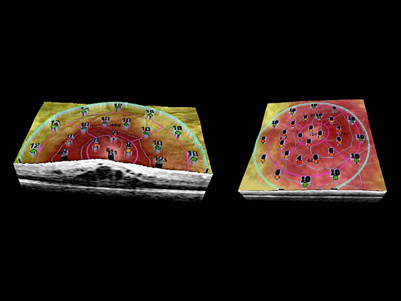 3-D topographic image