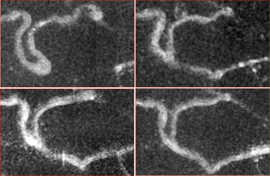 Dynamic histopathology image